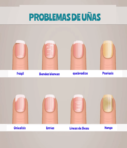 Servicio de Manicura consulta